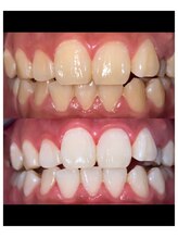 ホワイトニングビューティー 吉祥寺店/歯科提携で輝くホワイトニング