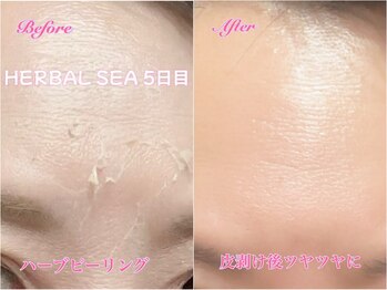 アロマアンドビューティー クリスタルローズ(CRYSTAL ROSE)/ハーブピーリング