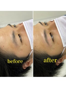 男眉salon OnFleek!渋谷店 【メンズ眉毛サロン・メンズアイブロウサロン】/眉毛は第一印象を決めます