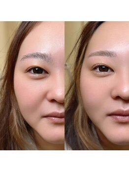 マ シェリ(ma cherie)/アイブロウ×まつげパーマ