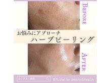 ルシアル(Rucial)の雰囲気（継続は美肌なり♪美容液導入とセットで驚きの変化を実感◎）