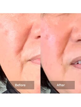 ヨサ パーク コアハート(YOSA PARK CORE HEART)/1回のYOSAでアップ！