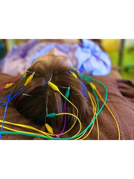 鍼灸施術を受けたい