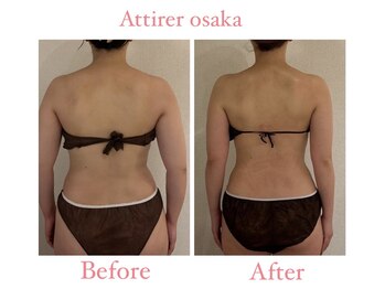 アティレ オオサカ(Attirer Osaka)/2024年秋冬婚/5か月経過