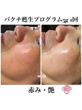 マシェリ(ma-che'rie)/バクチ甦生プログラム