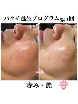 マシェリ(ma-che'rie)/バクチ甦生プログラム