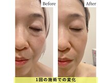 ハイケア グラン ギンザ(HYCARE GRAND GINZA)の雰囲気（1回の施術でも驚きの変化を実感！改善写真はフォトギャラリーへ）
