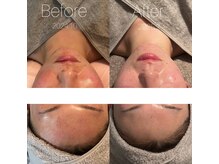 プララン 京都桂店(Plaran)/【CHRISTINA 】乳酸菌ピール