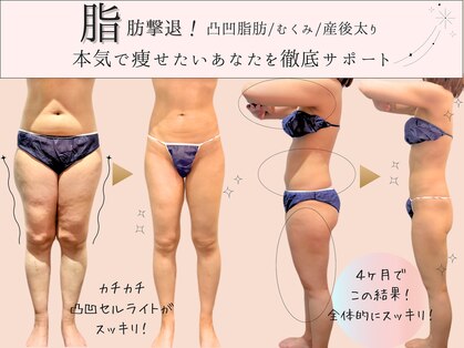 エクストリミティ 国立店(EXTREMITY)の写真