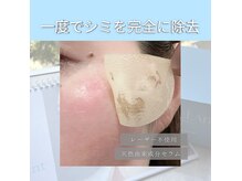 アティロン(Attirant)