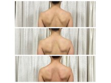 エステティックサロンアネラ(Anela)の雰囲気（ブライダル肩甲骨剥がしのプロ/巻き肩スゴ腕技術を体感◎1～7回）