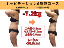 ビーバランス 本町店(美-Balance)/20代後半　月7部位コース