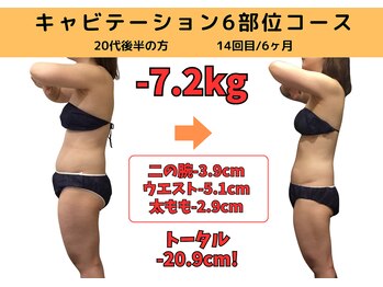 ビーバランス 本町店(美-Balance)/20代後半　月7部位コース