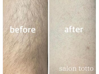 サロントット(salon totto)/before→after