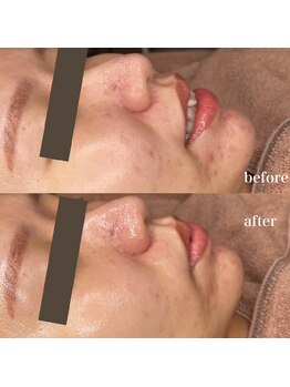 ルミナス(Luminous)/ララピール