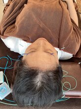 ハリファ鍼灸院 横浜関内院(HariFa鍼灸院)/美容施術/美容鍼