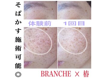 ブランシェ 金沢店 × 椿