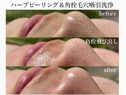 エステサロン ジョアアンジェ(joie ange)の写真