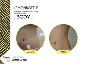 ソラ(sola*)/レモンボトル