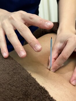 健康堂整骨院 都立大学院の写真/【産後ケア,慢性痛にも◎】身体の歪みが原因で起こる腰痛を[骨盤]から正しい状態に戻し身体全体を整えます!