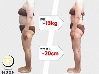 ムーン 高崎店(MOON)/痩身エステ