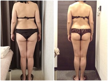 美容整体ウェリナ あま甚目寺院/小顔矯正/骨盤矯正/美脚サロン