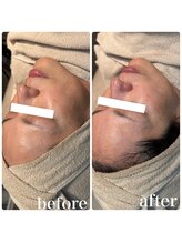 ディオーネ 春日井勝川店(Dione)/マーメイドセルトリートメント