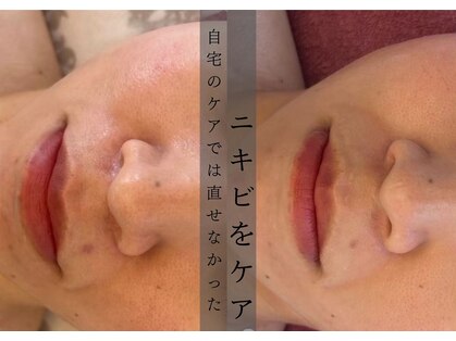 モアナ(Moana)の写真