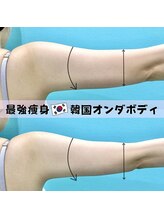 カンナムビューティー 福岡天神店/オンダリフト/福岡/ララピール