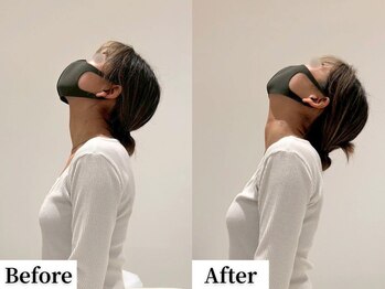 ソレア(Solea)/首こり改善1回目