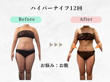 美容整体ウェリナ あま甚目寺院/.【ダイエットbefore→after】