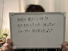 たるみアガル(たるみagaru)/板橋区　たるみ/フェイシャル