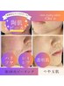 【マイルド陶肌】韓国式/陶肌ピール￥11,000