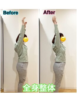 スカイ 鍼灸整骨院 整体院(SKY)/全身美容整体