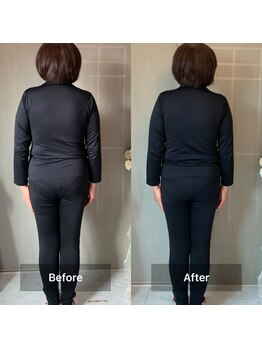 ヨサ パーク コアハート(YOSA PARK CORE HEART)/1回で背面スッキリ！