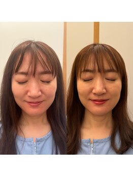 こうぞう整体院/美容鍼×筋膜リリース