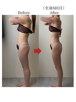 バーチュ(Virtue)/ボディーラインを整える☆