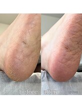 フットミー(foot mii)/