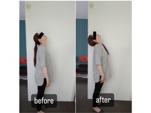イトウ カイロプラクティックパートナー(ITOU)/Before &After