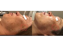 アミュレット(AMULET)の雰囲気（【皮膚理論に基づいたスキンケア】お肌のマイナス要因デトックス）
