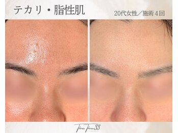 スリースリー(THREE THREE)/テカリ・脂性肌ケア
