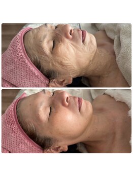 アネラ(ANERA)/ゾンビマスク