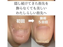 ポノポ(ponopo)