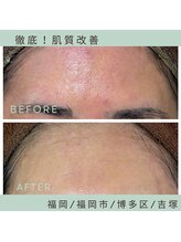 ソワ 吉塚店(soi)/敏感肌な体質でも◎