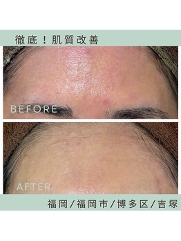 ソワ 吉塚店(soi)/敏感肌な体質でも◎