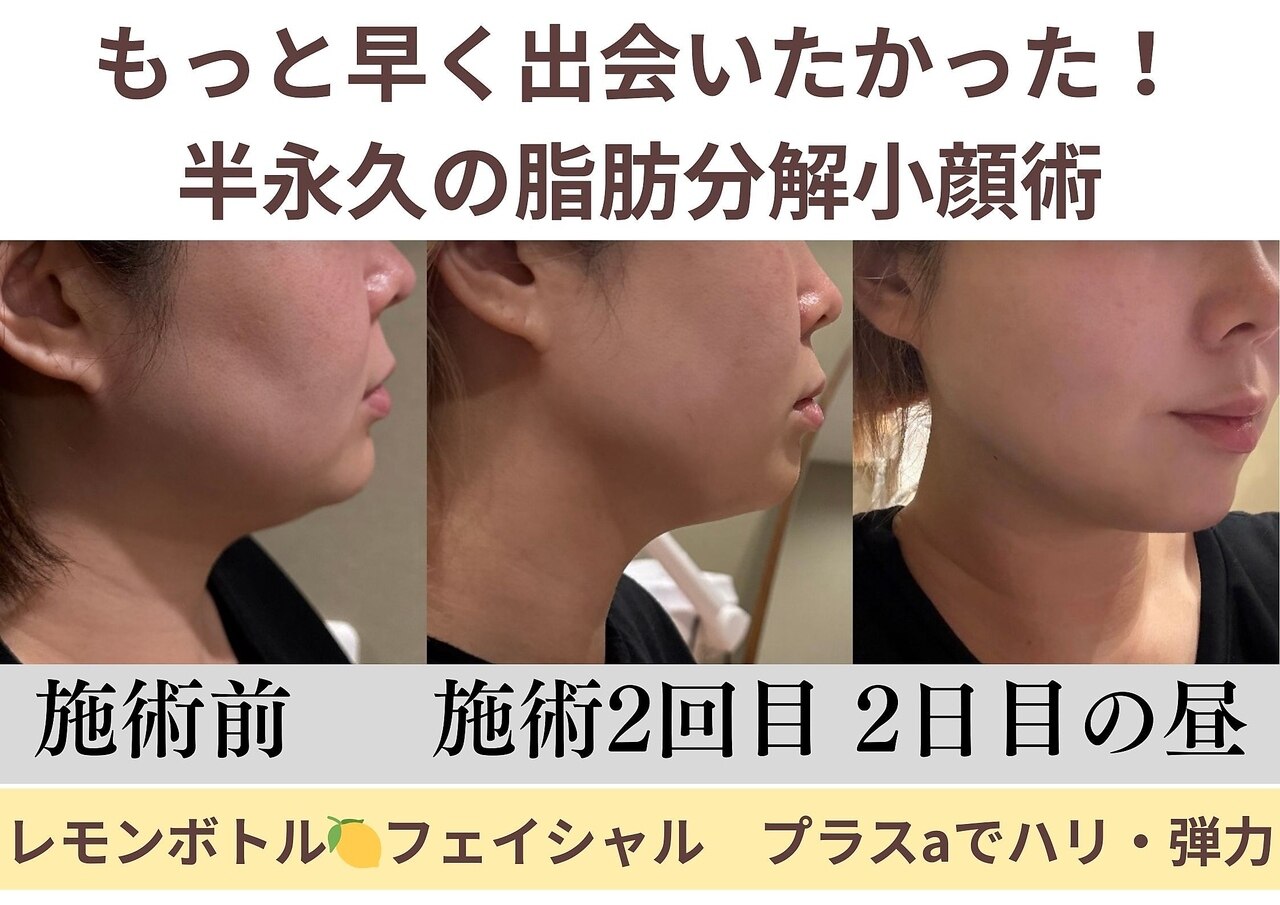 エス シークレット 金町店(S secret)｜ホットペッパービューティー