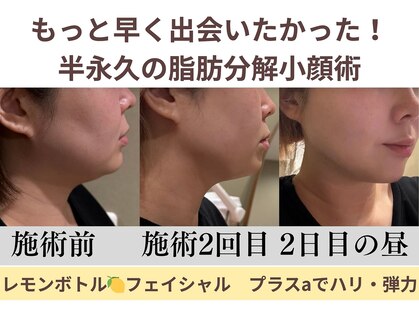 エス シークレット 金町店(S secret)の写真