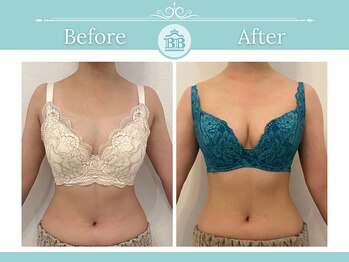 美人バスト 浜松店/◇ バストアップ &nbsp;BeforeAfter◇