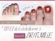 アウラ(aura)の写真/フット長さだし対応◎都内でも数少ない深爪矯正スカルプで理想の美フォルムへ導く人気サロン♪赤羽駅3分
