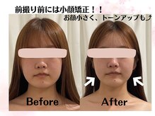 オリナサツキ(OlinaSatsuki)/前撮り前の小顔ケアに！